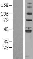 Western blot validation of overexpression lysate (Cat# LY402613) using anti-DDK antibody (Cat# TA50011-100). Left: Cell lysates from un-transfected HEK293T cells; Right: Cell lysates from HEK293T cells transfected with RC209110 using transfection reagent MegaTran 2.0 (Cat# TT210002).