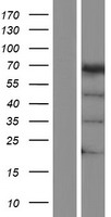 Western blot validation of overexpression lysate (Cat# LY400623) using anti-DDK antibody (Cat# TA50011-100). Left: Cell lysates from un-transfected HEK293T cells; Right: Cell lysates from HEK293T cells transfected with RC200737 using transfection reagent MegaTran 2.0 (Cat# TT210002).