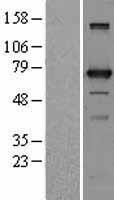 Western blot validation of overexpression lysate (Cat# LY402775) using anti-DDK antibody (Cat# TA50011-100). Left: Cell lysates from un-transfected HEK293T cells; Right: Cell lysates from HEK293T cells transfected with RC202643 using transfection reagent MegaTran 2.0 (Cat# TT210002).