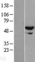Western blot validation of overexpression lysate (Cat# LY402903) using anti-DDK antibody (Cat# TA50011-100). Left: Cell lysates from un-transfected HEK293T cells; Right: Cell lysates from HEK293T cells transfected with RC200888 using transfection reagent MegaTran 2.0 (Cat# TT210002).