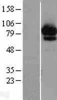 Western blot validation of overexpression lysate (Cat# LY402100) using anti-DDK antibody (Cat# TA50011-100). Left: Cell lysates from un-transfected HEK293T cells; Right: Cell lysates from HEK293T cells transfected with RC200323 using transfection reagent MegaTran 2.0 (Cat# TT210002).