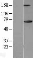 Western blot validation of overexpression lysate (Cat# LY400567) using anti-DDK antibody (Cat# TA50011-100). Left: Cell lysates from un-transfected HEK293T cells; Right: Cell lysates from HEK293T cells transfected with RC204048 using transfection reagent MegaTran 2.0 (Cat# TT210002).