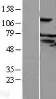 Western blot validation of overexpression lysate (Cat# LY427447) using anti-DDK antibody (Cat# TA50011-100). Left: Cell lysates from un-transfected HEK293T cells; Right: Cell lysates from HEK293T cells transfected with RC225957 using transfection reagent MegaTran 2.0 (Cat# TT210002).
