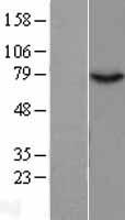 Western blot validation of overexpression lysate (Cat# LY403722) using anti-DDK antibody (Cat# TA50011-100). Left: Cell lysates from un-transfected HEK293T cells; Right: Cell lysates from HEK293T cells transfected with RC209885 using transfection reagent MegaTran 2.0 (Cat# TT210002).