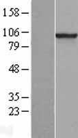 Western blot validation of overexpression lysate (Cat# LY400109) using anti-DDK antibody (Cat# TA50011-100). Left: Cell lysates from un-transfected HEK293T cells; Right: Cell lysates from HEK293T cells transfected with RC200445 using transfection reagent MegaTran 2.0 (Cat# TT210002).