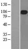 Western blot validation of overexpression lysate (Cat# LY402030) using anti-DDK antibody (Cat# TA50011-100). Left: Cell lysates from un-transfected HEK293T cells; Right: Cell lysates from HEK293T cells transfected with RC214639 using transfection reagent MegaTran 2.0 (Cat# TT210002).
