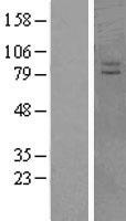 Western blot validation of overexpression lysate (Cat# LY403311) using anti-DDK antibody (Cat# TA50011-100). Left: Cell lysates from un-transfected HEK293T cells; Right: Cell lysates from HEK293T cells transfected with RC218454 using transfection reagent MegaTran 2.0 (Cat# TT210002).