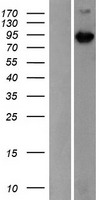 Western blot validation of overexpression lysate (Cat# LY400363) using anti-DDK antibody (Cat# TA50011-100). Left: Cell lysates from un-transfected HEK293T cells; Right: Cell lysates from HEK293T cells transfected with RC223307 using transfection reagent MegaTran 2.0 (Cat# TT210002).