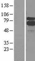 Western blot validation of overexpression lysate (Cat# LY400234) using anti-DDK antibody (Cat# TA50011-100). Left: Cell lysates from un-transfected HEK293T cells; Right: Cell lysates from HEK293T cells transfected with RC217259 using transfection reagent MegaTran 2.0 (Cat# TT210002).