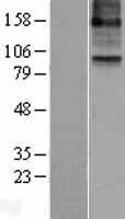 Western blot validation of overexpression lysate (Cat# LY400457) using anti-DDK antibody (Cat# TA50011-100). Left: Cell lysates from un-transfected HEK293T cells; Right: Cell lysates from HEK293T cells transfected with RC211380 using transfection reagent MegaTran 2.0 (Cat# TT210002).