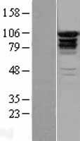 Western blot validation of overexpression lysate (Cat# LY402859) using anti-DDK antibody (Cat# TA50011-100). Left: Cell lysates from un-transfected HEK293T cells; Right: Cell lysates from HEK293T cells transfected with RC215194 using transfection reagent MegaTran 2.0 (Cat# TT210002).