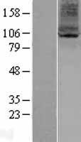 Western blot validation of overexpression lysate (Cat# LY402947) using anti-DDK antibody (Cat# TA50011-100). Left: Cell lysates from un-transfected HEK293T cells; Right: Cell lysates from HEK293T cells transfected with RC204774 using transfection reagent MegaTran 2.0 (Cat# TT210002).