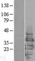 Western blot validation of overexpression lysate (Cat# LY402021) using anti-DDK antibody (Cat# TA50011-100). Left: Cell lysates from un-transfected HEK293T cells; Right: Cell lysates from HEK293T cells transfected with RC200245 using transfection reagent MegaTran 2.0 (Cat# TT210002).