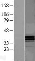 Western blot validation of overexpression lysate (Cat# LY400616) using anti-DDK antibody (Cat# TA50011-100). Left: Cell lysates from un-transfected HEK293T cells; Right: Cell lysates from HEK293T cells transfected with RC204713 using transfection reagent MegaTran 2.0 (Cat# TT210002).