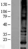 Western blot validation of overexpression lysate (Cat# LY403116) using anti-DDK antibody (Cat# TA50011-100). Left: Cell lysates from un-transfected HEK293T cells; Right: Cell lysates from HEK293T cells transfected with RC205634 using transfection reagent MegaTran 2.0 (Cat# TT210002).