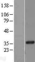 Western blot validation of overexpression lysate (Cat# LY401485) using anti-DDK antibody (Cat# TA50011-100). Left: Cell lysates from un-transfected HEK293T cells; Right: Cell lysates from HEK293T cells transfected with RC218430 using transfection reagent MegaTran 2.0 (Cat# TT210002).