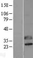 Western blot validation of overexpression lysate (Cat# LY403129) using anti-DDK antibody (Cat# TA50011-100). Left: Cell lysates from un-transfected HEK293T cells; Right: Cell lysates from HEK293T cells transfected with RC221551 using transfection reagent MegaTran 2.0 (Cat# TT210002).