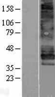 Western blot validation of overexpression lysate (Cat# LY426542) using anti-DDK antibody (Cat# TA50011-100). Left: Cell lysates from un-transfected HEK293T cells; Right: Cell lysates from HEK293T cells transfected with RC225723 using transfection reagent MegaTran 2.0 (Cat# TT210002).