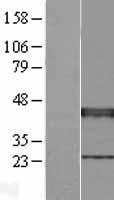 Western blot validation of overexpression lysate (Cat# LY420224) using anti-DDK antibody (Cat# TA50011-100). Left: Cell lysates from un-transfected HEK293T cells; Right: Cell lysates from HEK293T cells transfected with RC214791 using transfection reagent MegaTran 2.0 (Cat# TT210002).