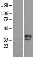 Western blot validation of overexpression lysate (Cat# LY400035) using anti-DDK antibody (Cat# TA50011-100). Left: Cell lysates from un-transfected HEK293T cells; Right: Cell lysates from HEK293T cells transfected with RC200389 using transfection reagent MegaTran 2.0 (Cat# TT210002).