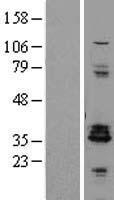 Western blot validation of overexpression lysate (Cat# LY427669) using anti-DDK antibody (Cat# TA50011-100). Left: Cell lysates from un-transfected HEK293T cells; Right: Cell lysates from HEK293T cells transfected with RC227805 using transfection reagent MegaTran 2.0 (Cat# TT210002).