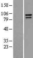 Western blot validation of overexpression lysate (Cat# LY400708) using anti-DDK antibody (Cat# TA50011-100). Left: Cell lysates from un-transfected HEK293T cells; Right: Cell lysates from HEK293T cells transfected with RC201766 using transfection reagent MegaTran 2.0 (Cat# TT210002).