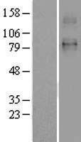 Western blot validation of overexpression lysate (Cat# LY400034) using anti-DDK antibody (Cat# TA50011-100). Left: Cell lysates from un-transfected HEK293T cells; Right: Cell lysates from HEK293T cells transfected with RC209261 using transfection reagent MegaTran 2.0 (Cat# TT210002).