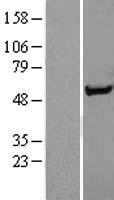 Western blot validation of overexpression lysate (Cat# LY401080) using anti-DDK antibody (Cat# TA50011-100). Left: Cell lysates from un-transfected HEK293T cells; Right: Cell lysates from HEK293T cells transfected with RC204480 using transfection reagent MegaTran 2.0 (Cat# TT210002).