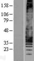 Western blot validation of overexpression lysate (Cat# LY428406) using anti-DDK antibody (Cat# TA50011-100). Left: Cell lysates from un-transfected HEK293T cells; Right: Cell lysates from HEK293T cells transfected with RC227473 using transfection reagent MegaTran 2.0 (Cat# TT210002).