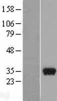 Western blot validation of overexpression lysate (Cat# LY402204) using anti-DDK antibody (Cat# TA50011-100). Left: Cell lysates from un-transfected HEK293T cells; Right: Cell lysates from HEK293T cells transfected with RC203069 using transfection reagent MegaTran 2.0 (Cat# TT210002).