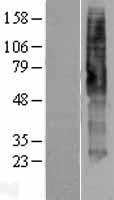 Western blot validation of overexpression lysate (Cat# LY421709) using anti-DDK antibody (Cat# TA50011-100). Left: Cell lysates from un-transfected HEK293T cells; Right: Cell lysates from HEK293T cells transfected with RC217913 using transfection reagent MegaTran 2.0 (Cat# TT210002).