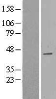 Western blot validation of overexpression lysate (Cat# LY403465) using anti-DDK antibody (Cat# TA50011-100). Left: Cell lysates from un-transfected HEK293T cells; Right: Cell lysates from HEK293T cells transfected with RC206393 using transfection reagent MegaTran 2.0 (Cat# TT210002).