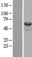 Western blot validation of overexpression lysate (Cat# LY400041) using anti-DDK antibody (Cat# TA50011-100). Left: Cell lysates from un-transfected HEK293T cells; Right: Cell lysates from HEK293T cells transfected with RC200639 using transfection reagent MegaTran 2.0 (Cat# TT210002).