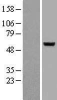 Western blot validation of overexpression lysate (Cat# LY400032) using anti-DDK antibody (Cat# TA50011-100). Left: Cell lysates from un-transfected HEK293T cells; Right: Cell lysates from HEK293T cells transfected with RC204074 using transfection reagent MegaTran 2.0 (Cat# TT210002).