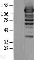 Western blot validation of overexpression lysate (Cat# LY402730) using anti-DDK antibody (Cat# TA50011-100). Left: Cell lysates from un-transfected HEK293T cells; Right: Cell lysates from HEK293T cells transfected with RC205485 using transfection reagent MegaTran 2.0 (Cat# TT210002).