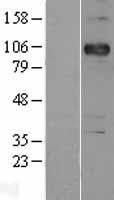 Western blot validation of overexpression lysate (Cat# LY400683) using anti-DDK antibody (Cat# TA50011-100). Left: Cell lysates from un-transfected HEK293T cells; Right: Cell lysates from HEK293T cells transfected with RC207346 using transfection reagent MegaTran 2.0 (Cat# TT210002).
