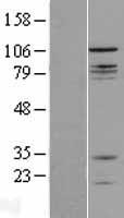 Western blot validation of overexpression lysate (Cat# LY403286) using anti-DDK antibody (Cat# TA50011-100). Left: Cell lysates from un-transfected HEK293T cells; Right: Cell lysates from HEK293T cells transfected with RC205876 using transfection reagent MegaTran 2.0 (Cat# TT210002).