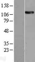 Western blot validation of overexpression lysate (Cat# LY402909) using anti-DDK antibody (Cat# TA50011-100). Left: Cell lysates from un-transfected HEK293T cells; Right: Cell lysates from HEK293T cells transfected with RC220429 using transfection reagent MegaTran 2.0 (Cat# TT210002).