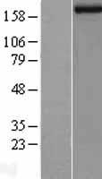 Western blot validation of overexpression lysate (Cat# LY401985) using anti-DDK antibody (Cat# TA50011-100). Left: Cell lysates from un-transfected HEK293T cells; Right: Cell lysates from HEK293T cells transfected with RC214918 using transfection reagent MegaTran 2.0 (Cat# TT210002).