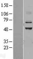Western blot validation of overexpression lysate (Cat# LY402769) using anti-DDK antibody (Cat# TA50011-100). Left: Cell lysates from un-transfected HEK293T cells; Right: Cell lysates from HEK293T cells transfected with RC201457 using transfection reagent MegaTran 2.0 (Cat# TT210002).