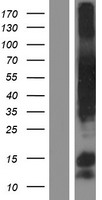 Western blot validation of overexpression lysate (Cat# LY413557) using anti-DDK antibody (Cat# TA50011-100). Left: Cell lysates from un-transfected HEK293T cells; Right: Cell lysates from HEK293T cells transfected with RC203078 using transfection reagent MegaTran 2.0 (Cat# TT210002).