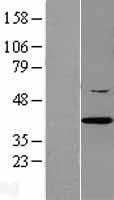 Western blot validation of overexpression lysate (Cat# LY411959) using anti-DDK antibody (Cat# TA50011-100). Left: Cell lysates from un-transfected HEK293T cells; Right: Cell lysates from HEK293T cells transfected with RC201006 using transfection reagent MegaTran 2.0 (Cat# TT210002).