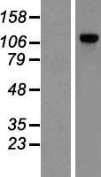Western blot validation of overexpression lysate (Cat# LY429038) using anti-DDK antibody (Cat# TA50011-100). Left: Cell lysates from un-transfected HEK293T cells; Right: Cell lysates from HEK293T cells transfected with RC226611 using transfection reagent MegaTran 2.0 (Cat# TT210002).