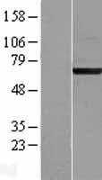 Western blot validation of overexpression lysate (Cat# LY411600) using anti-DDK antibody (Cat# TA50011-100). Left: Cell lysates from un-transfected HEK293T cells; Right: Cell lysates from HEK293T cells transfected with RC208434 using transfection reagent MegaTran 2.0 (Cat# TT210002).