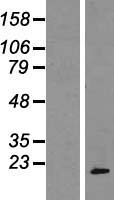 Western blot validation of overexpression lysate (Cat# LY417024) using anti-DDK antibody (Cat# TA50011-100). Left: Cell lysates from un-transfected HEK293T cells; Right: Cell lysates from HEK293T cells transfected with RC200582 using transfection reagent MegaTran 2.0 (Cat# TT210002).