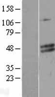 Western blot validation of overexpression lysate (Cat# LY409750) using anti-DDK antibody (Cat# TA50011-100). Left: Cell lysates from un-transfected HEK293T cells; Right: Cell lysates from HEK293T cells transfected with RC203734 using transfection reagent MegaTran 2.0 (Cat# TT210002).