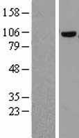 Western blot validation of overexpression lysate (Cat# LY414174) using anti-DDK antibody (Cat# TA50011-100). Left: Cell lysates from un-transfected HEK293T cells; Right: Cell lysates from HEK293T cells transfected with RC209018 using transfection reagent MegaTran 2.0 (Cat# TT210002).