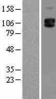 Western blot validation of overexpression lysate (Cat# LY418960) using anti-DDK antibody (Cat# TA50011-100). Left: Cell lysates from un-transfected HEK293T cells; Right: Cell lysates from HEK293T cells transfected with RC209822 using transfection reagent MegaTran 2.0 (Cat# TT210002).