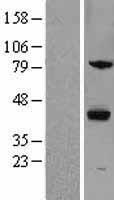 Western blot validation of overexpression lysate (Cat# LY416259) using anti-DDK antibody (Cat# TA50011-100). Left: Cell lysates from un-transfected HEK293T cells; Right: Cell lysates from HEK293T cells transfected with RC202682 using transfection reagent MegaTran 2.0 (Cat# TT210002).