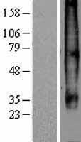 Western blot validation of overexpression lysate (Cat# LY419718) using anti-DDK antibody (Cat# TA50011-100). Left: Cell lysates from un-transfected HEK293T cells; Right: Cell lysates from HEK293T cells transfected with RC206614 using transfection reagent MegaTran 2.0 (Cat# TT210002).